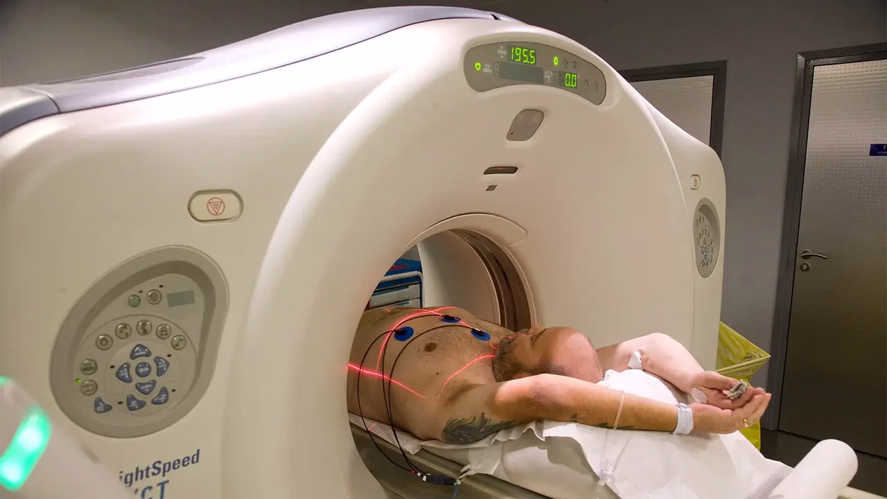 سی‌تی آنژیو قلب چیست +مراحل انجام آن